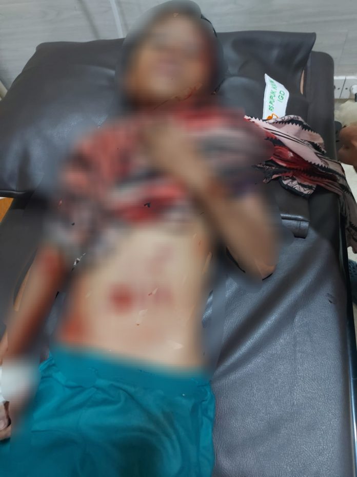 Bocah 12 Tahun Diterkam Buaya Saat Berenang di Loktuan